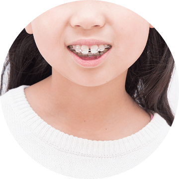 間違った食べ方や口周りのクセ