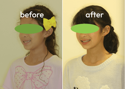 症例前後の比較