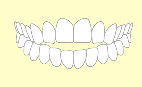 開咬の歯並び