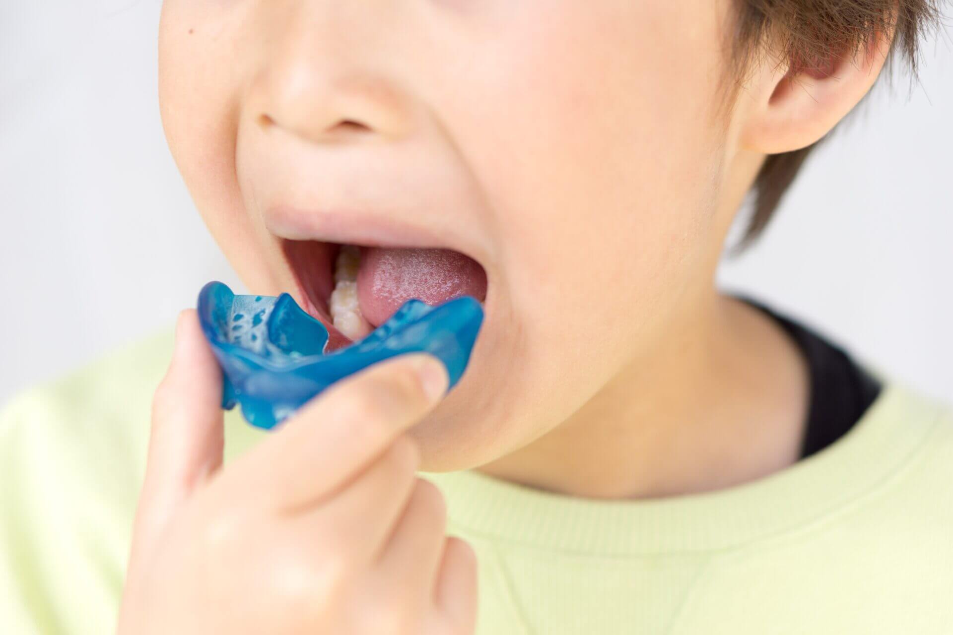 マイオブレース矯正