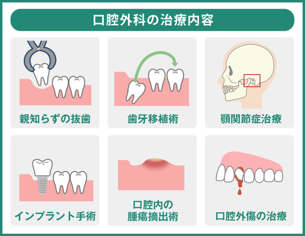 口腔外科の治療内容