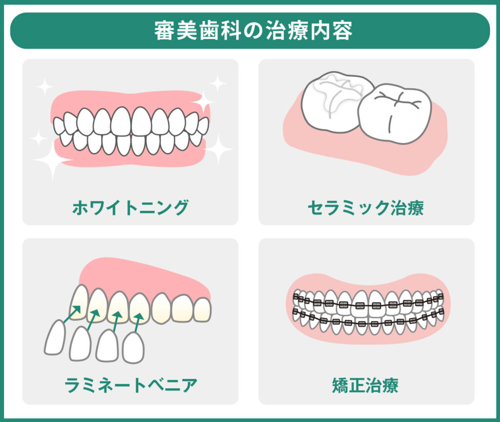 審美歯科の治療内容